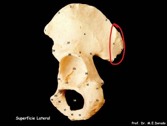 ¿cuál es la tuberosidad iliaca?
