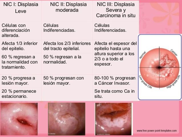 CÁNCER INVASOR DE CÉRVIX Y VAGINA