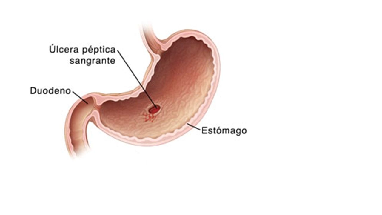 Sesión 26: Alteraciones gastrointestinales y hematológicas durante el embarazo