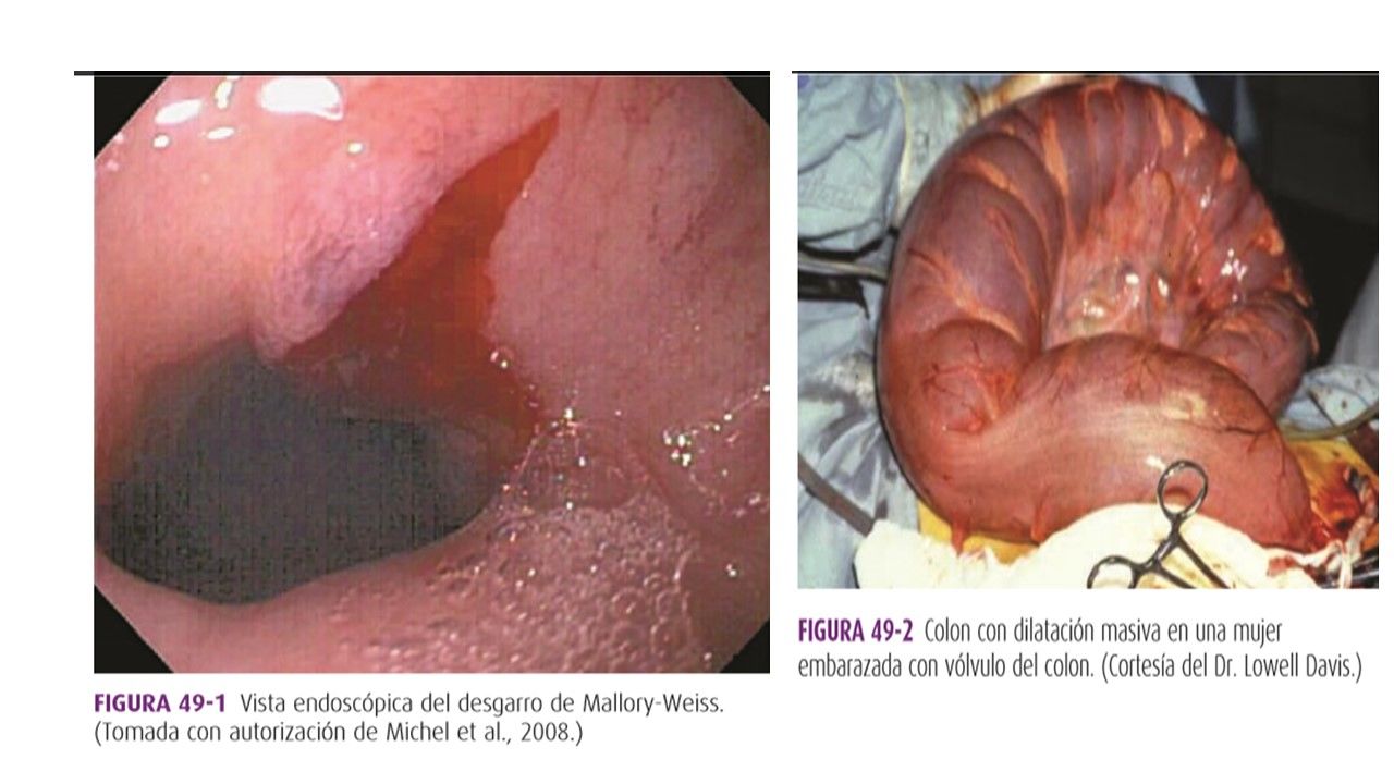 Sesión 26: Alteraciones gastrointestinales y hematológicas durante el embarazo
