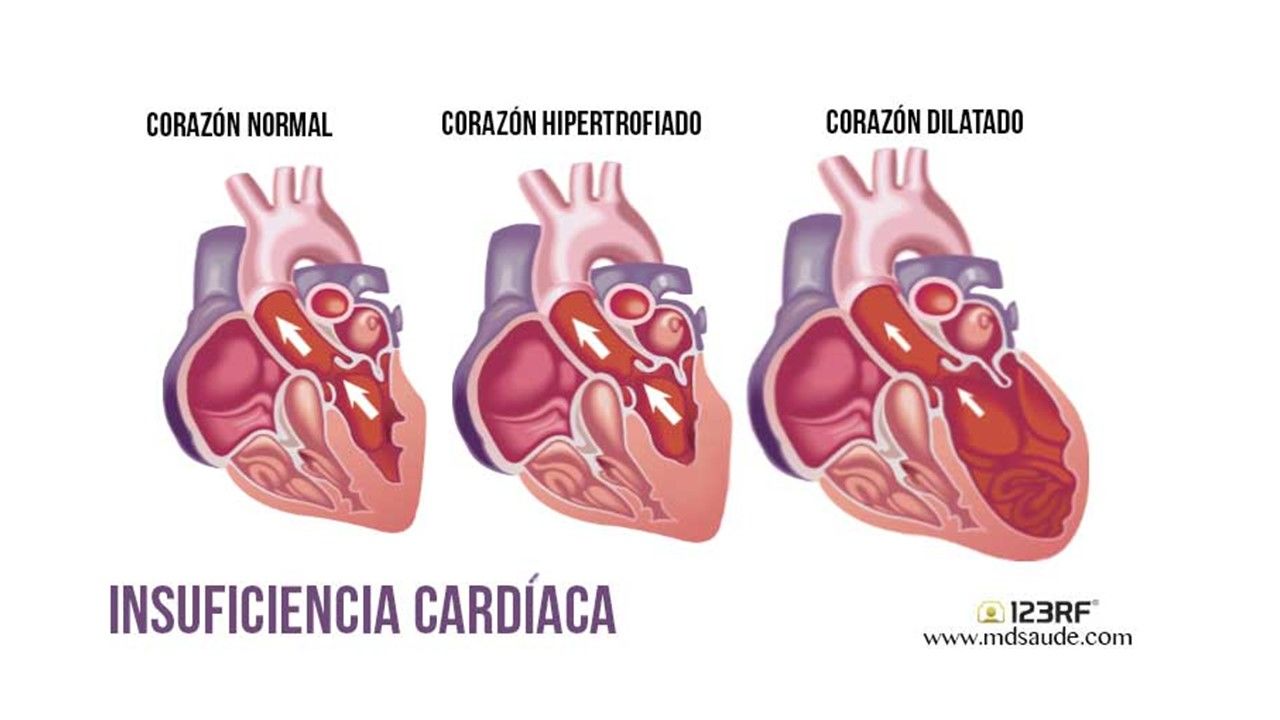 Sesión 25: Enfermedad del corazón, pulmón y riñón durante el embarazo.