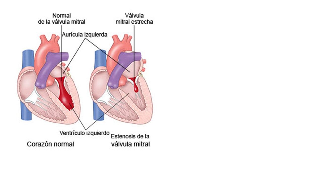 Sesión 25: Enfermedad del corazón, pulmón y riñón durante el embarazo.