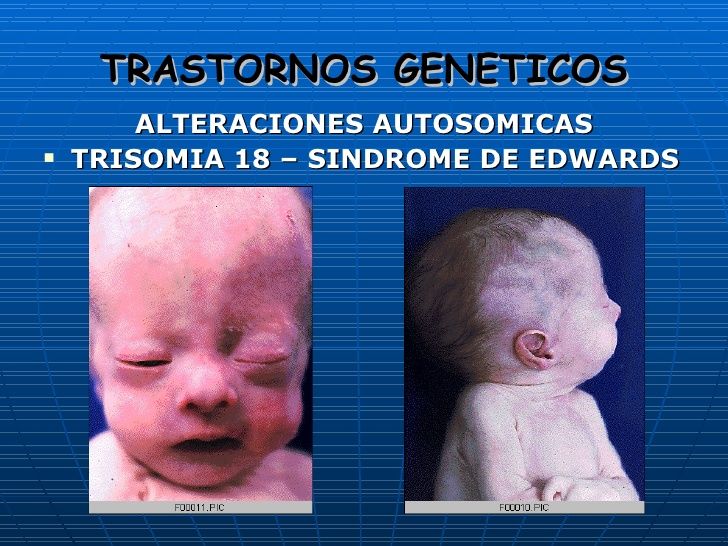 El Inicio De La Vida Genética Y Desarrollo Prenatal