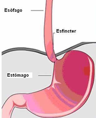 quais parte do corpo são envolvidos no refluxo gastroesofágico ?