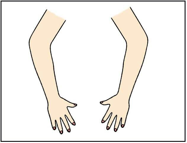 arms