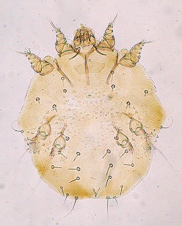Ordem Acarina - Família Sarcoptidae - Gênero Sarcoptes - Possui espinhos e escamas - Aspecto de amora - Palpos e quelíceras