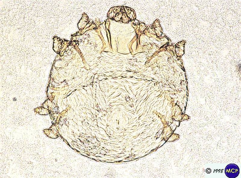Ordem Acarina - Família Sarcoptidae - Gênero Cnemidocoptes - Não possui espinhos e escamas - Corpo mais redondo de todos - Cabeça e patas...