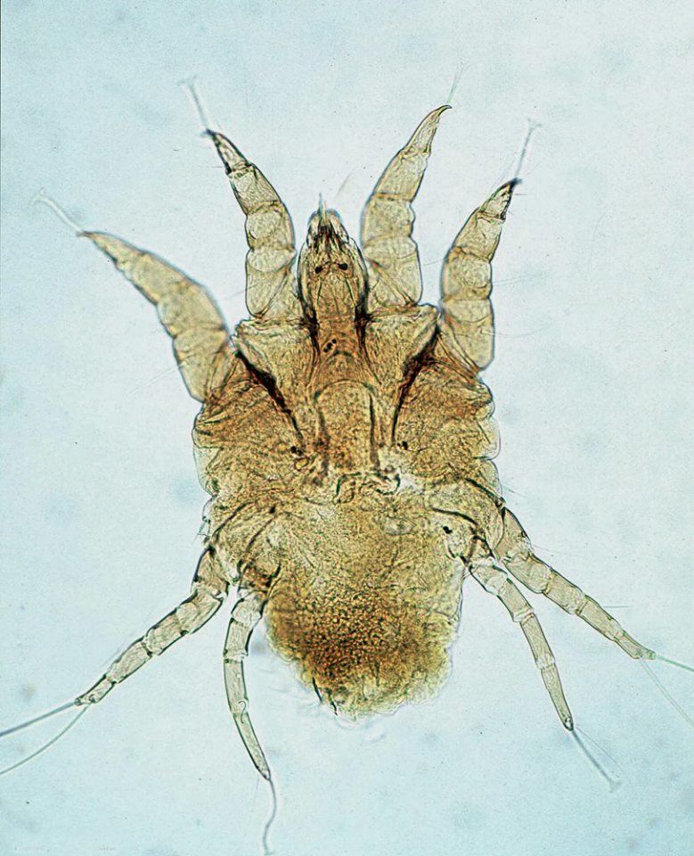 Ordem Acarina - Família Psoroptdae - Gênero Psoroptes - Rosto longo em forma de cone - Macho tem prolongamentos abdominais - Pedicelo tri...