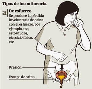 INCONTINENCIA URINARIA, PROLAPSO GENITAL Y TRANSTORNOS DEL PISO PELVICO