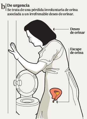 INCONTINENCIA URINARIA, PROLAPSO GENITAL Y TRANSTORNOS DEL PISO PELVICO