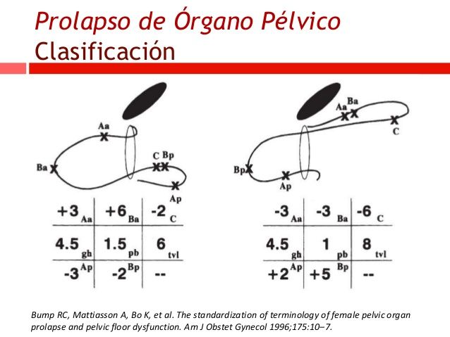 INCONTINENCIA URINARIA, PROLAPSO GENITAL Y TRANSTORNOS DEL PISO PELVICO