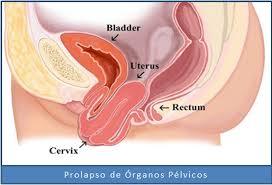 INCONTINENCIA URINARIA, PROLAPSO GENITAL Y TRANSTORNOS DEL PISO PELVICO