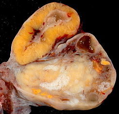 HISTOLOGÍA DEL APARATO REPRODUCTOR FEMENINO