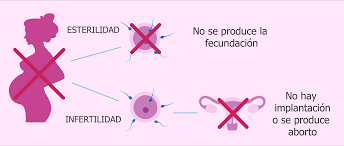 INFERTILIDAD, ABORTO EXPONTANEO Y RECURRENTE