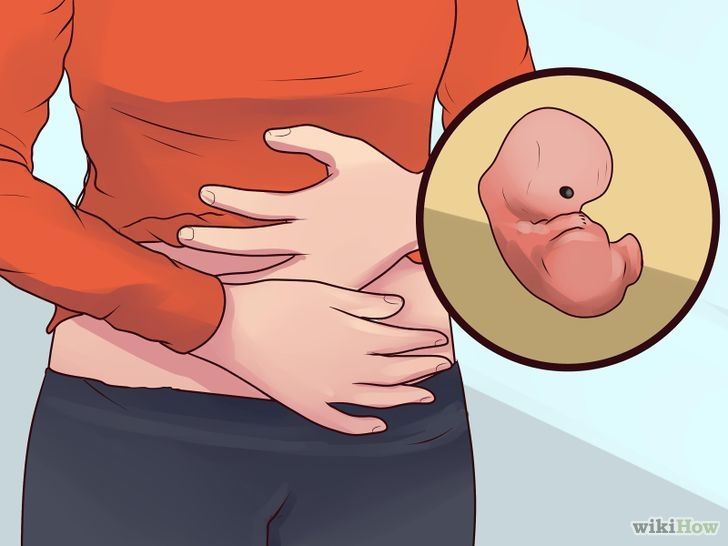 INFERTILIDAD, ABORTO EXPONTANEO Y RECURRENTE