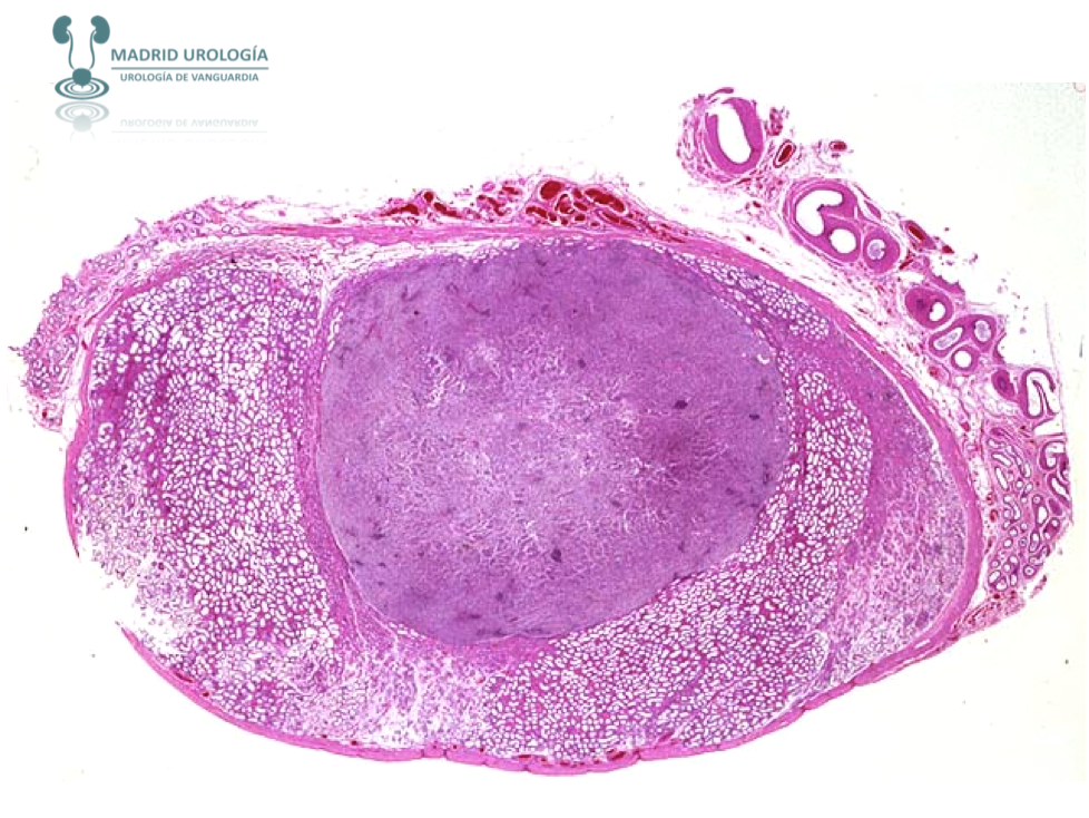 HISTOLOGÍA DEL APARATO REPRODUCTOR MASCULINO