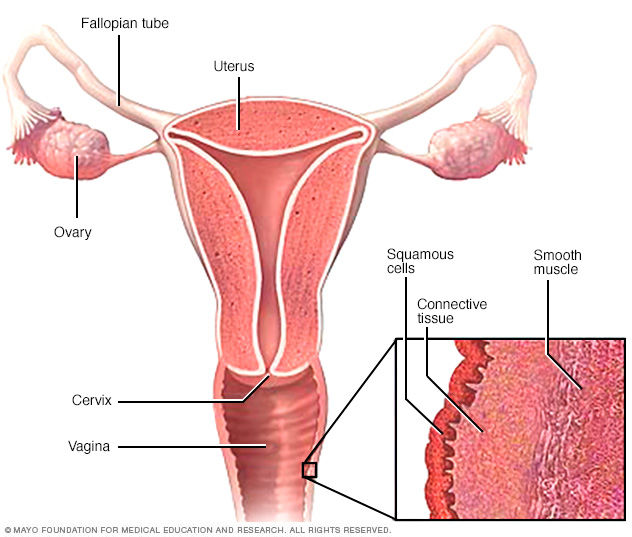 CÁNCER INVASOR DE CÉRVIX Y VAGINA