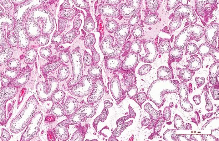 Histología del sistema reproductor masculino