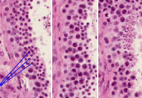 Block C Histology