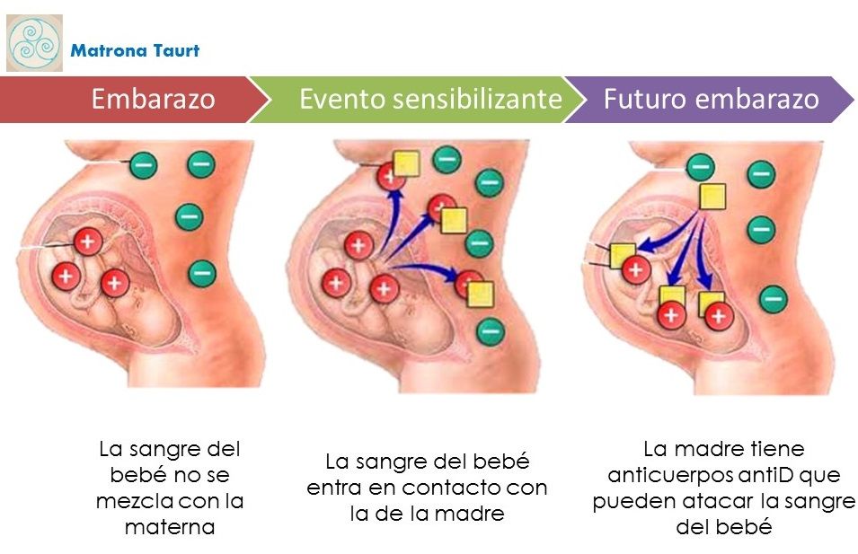 Eritroblastosis fetal *trastorno sanguíneo en un bebe recién nacido *se produce cuando la mama tiene distinto grupo sanguíneo