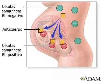 Trastornos del embarazo