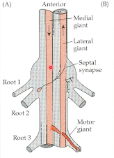 What's the difference between the MGI and the LGI?