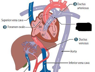 Pulmonary artery