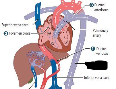 Aorta