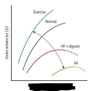 Ventricular EDV (preload)