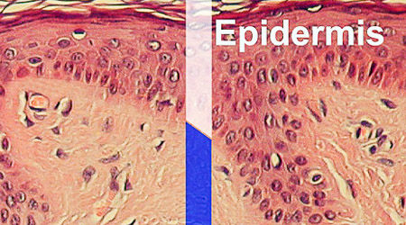 Epidermis