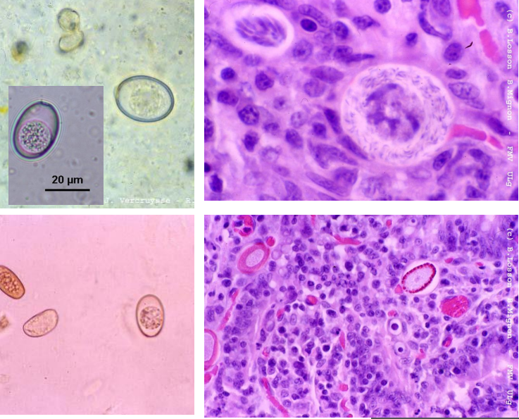EIMERIA sp. Ookystes Sphériques à ellipsoïdaux 20 – 40 µm Un bouchon polaire chez certaines espèces Schizonte comprenant des mérozoïtes ...