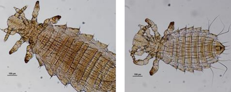 Polyplax spinulosa Pou piqueur Vecteur d’Encephalitozoon cuniculi, d’Haemobartonella muris et de Pasteurella tularensis