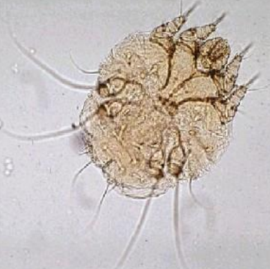 Trixacarus caviae Ressemble à Sarcoptes scabiei mais plus petit: 150 à 250 µm Rostre court et arrondi Pattes courtes Pédicule long ...