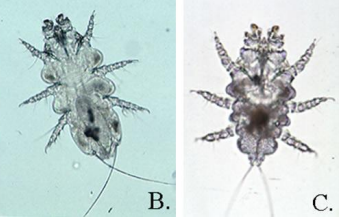Myocoptes musculinus souris labo +++ Femelle: 300µm, Stries dorsales comme des écailles, Larges chélicères, Pattes I et II: ventouses, ...