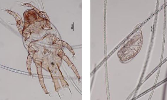 Leporacarus gibbus lapin Portage asymptomatique +++ 450-500 µm pour la femelle, mâle + petit Forme générale proche de celle d’une puce Ap...