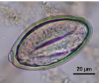 Oxyuris equi TS, ovale, paroi épaisse et lisse, un bouchon polaire, légèrement asymétrique