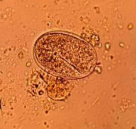 Strongyloides sp Coque mince, embryon, 40-60µm