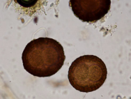 Parascaris equorum TS, couleur foncée, paroi très épaisse et alvéolée