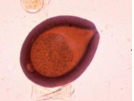 Eimeria leuckarti Très grand, coloré