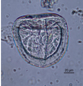 Anoplocephala sp TS, triangulaire à quadrangulaire, contient un embryon hexacanthe