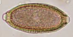 Trichuris vulpis TS, forme de citron, 2 bouchons polaires