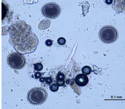 Toxocara canis TS, brun foncé, paroi finement alvéolée