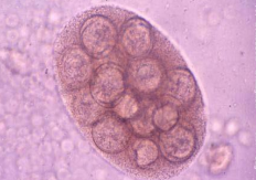 Dipylidium caninum Capsule ovigère, contient 10-20 oeufs