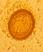 Taenia sp Rond, 30-60µm, coque lisse et épaisse