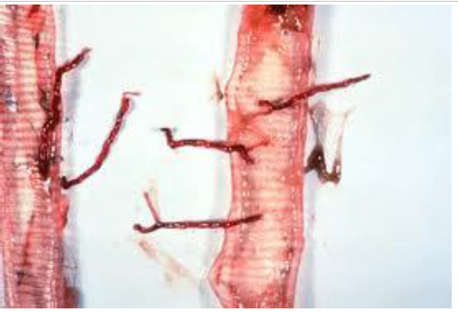 SYNGAMUS TRACHEA Adultes : forme en Y Femelle : grande barre du Y Mâle : petite barre du Y Rouge 40mm