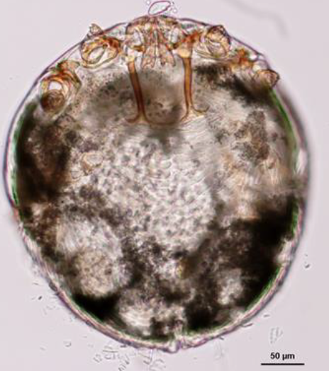 CNEMIDOCOPTES SP Ressemble à un sarcoptes sp. Corps arrondi Pattes courtes Pas d'épines dorsales