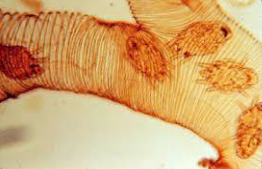 ACARAPIS WOODY Localisation : trachée 125-140µm Forme ovoïde Rostre allongé
