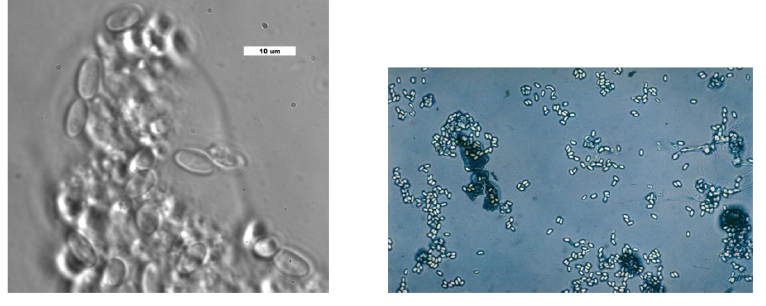 NOSEMA SP Spores dans les intestins