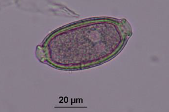CAPILLARIA SP. Oeuf : 50-60 µm Bouchons polaires aplatis Bleu-gris