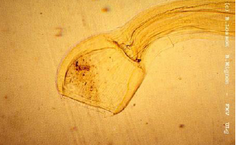 CHABERTIA OVINA 1.5-2cm de long Capsule buccale énorme en forme de cloche Pas de dent Double rangée de papille